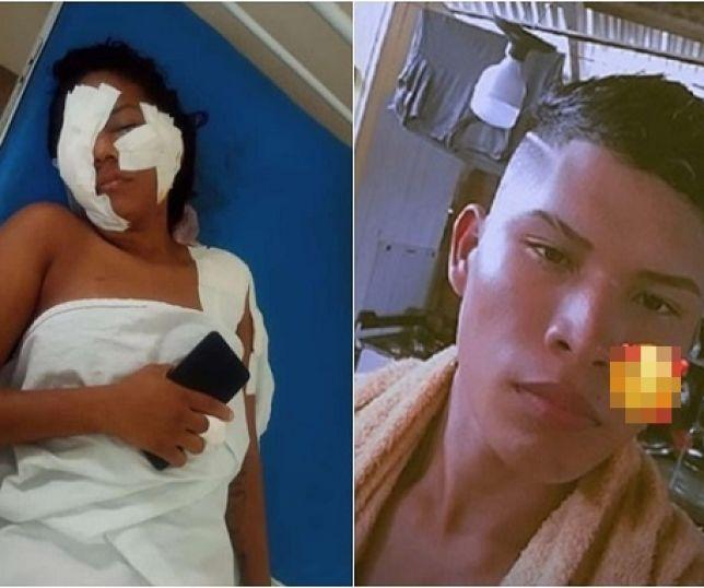IMAGENS FORTES! HOMEM NÃO ACEITA O FIM DO RELACIONAMENTO E TENTA MATAR EX-COMPANHEIRA COM 17 FACADAS NO MUNICÍPIO DE BERURI, INTERIOR DO AMAZONAS. VEJ