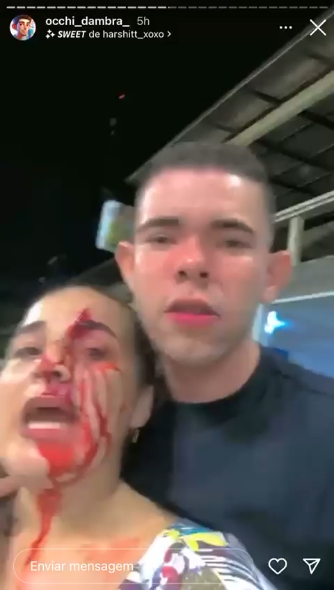 NO AMAZONAS, DELEGADO COVARDE E CAPACHO DO PREFEITO AGRIDE MULHER POR CRITICAR A GESTÃO MUNICIPALS